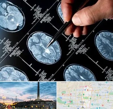 دکتر تشنج در منطقه 2 تهران 