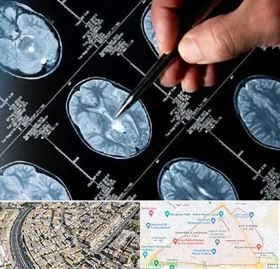 دکتر تشنج در شهرک غرب مشهد 