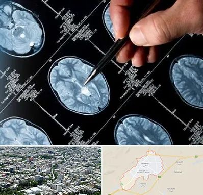 دکتر تشنج در شاهرود
