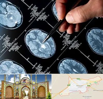 دکتر تشنج در سمنان