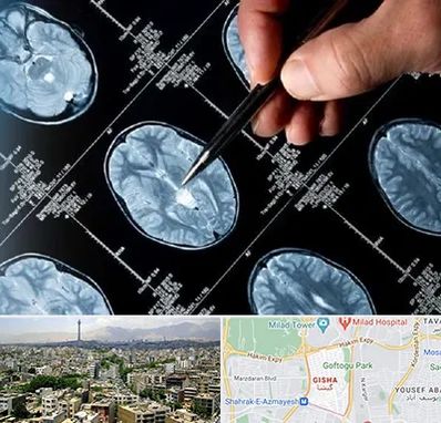 دکتر تشنج در گیشا 