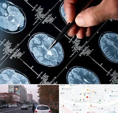 دکتر تشنج در کارگر شمالی 