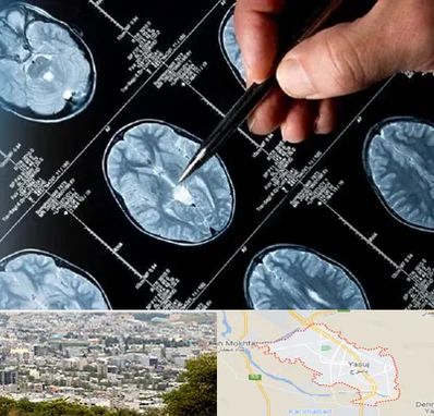 دکتر تشنج در یاسوج