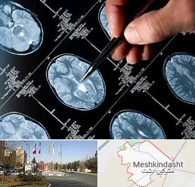 دکتر تشنج در مشکین دشت