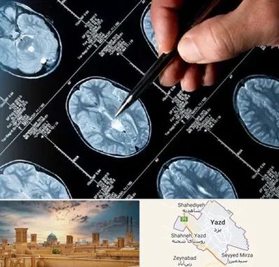 دکتر تشنج در یزد