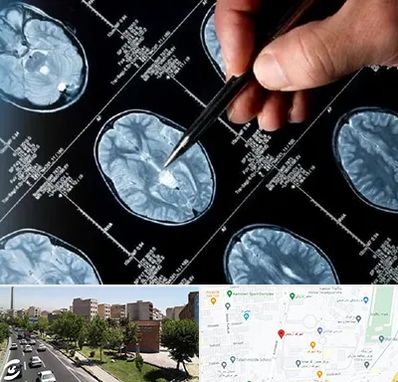 دکتر تشنج در شهرک آزمایش 