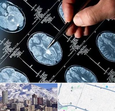 دکتر تشنج در ازگل