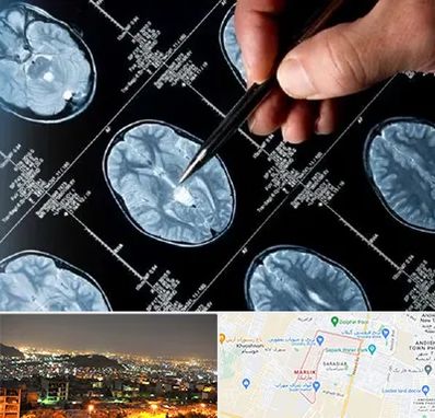 دکتر تشنج در مارلیک کرج 