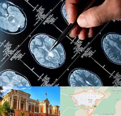 دکتر تشنج در خوی