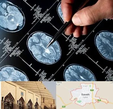 دکتر تشنج در ساوه