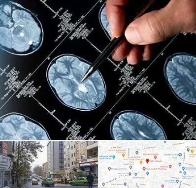 دکتر تشنج در فاطمی 