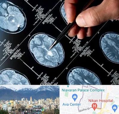 دکتر تشنج در آجودانیه