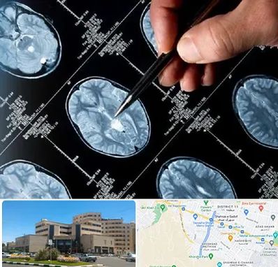 دکتر تشنج در صیاد شیرازی مشهد 