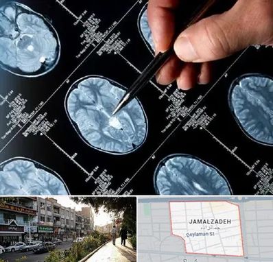 دکتر تشنج در خیابان جمالزاده