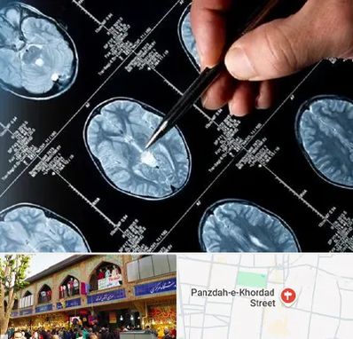 دکتر تشنج در 15 خرداد