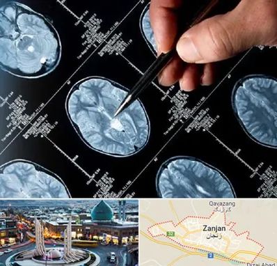 دکتر تشنج در زنجان