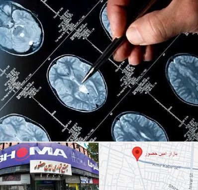 دکتر تشنج در امین حضور