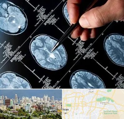 دکتر تشنج در شرق تهران 