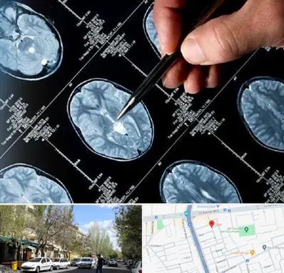 دکتر تشنج در کوی فیروز تبریز