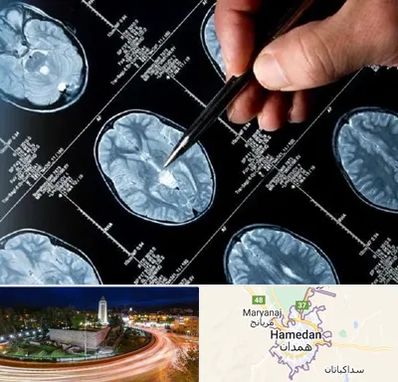 دکتر تشنج در همدان