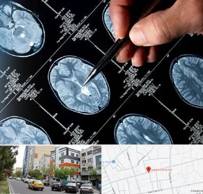 دکتر تشنج در هفده شهریور تبریز