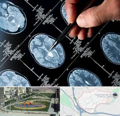 دکتر تشنج در مرزداران تبریز