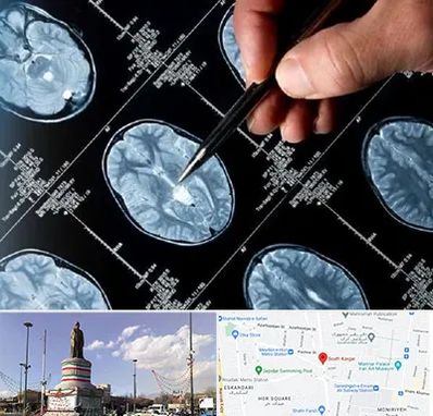 دکتر تشنج در کارگر جنوبی 