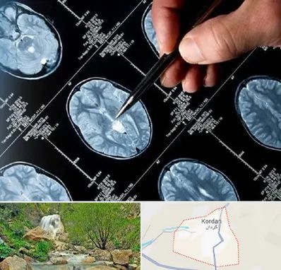 دکتر تشنج در کردان