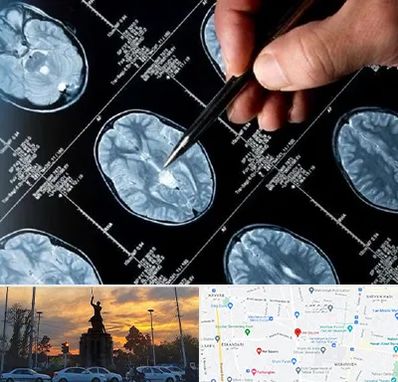 دکتر تشنج در میدان حر 