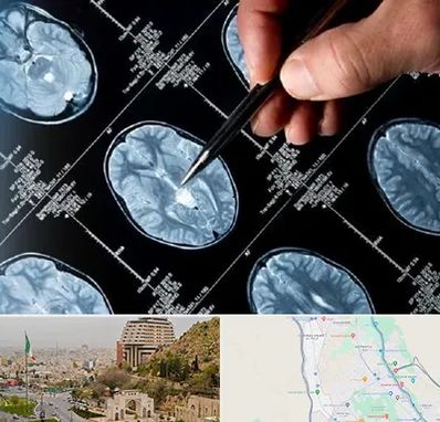 دکتر تشنج در فرهنگ شهر شیراز 