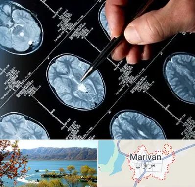 دکتر تشنج در مریوان