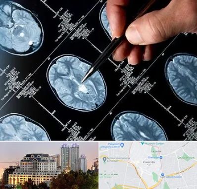 دکتر تشنج در فرشته 