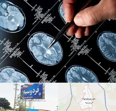 دکتر تشنج در فردوسیه شهریار