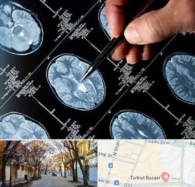 دکتر تشنج در تربیت تبریز