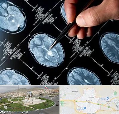 دکتر تشنج در بومهن