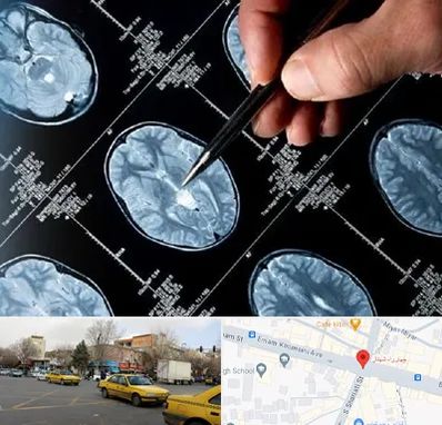 دکتر تشنج در شهناز تبریز