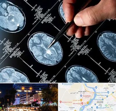 دکتر تشنج در کیانپارس اهواز 