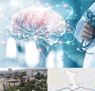 دکتر سکته مغزی در اوین