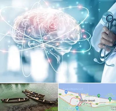 دکتر سکته مغزی در بندر انزلی