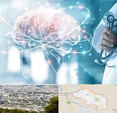 دکتر سکته مغزی در یاسوج