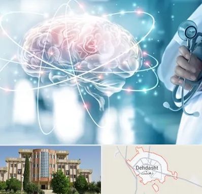 دکتر سکته مغزی در دهدشت