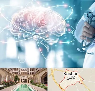 دکتر سکته مغزی در کاشان