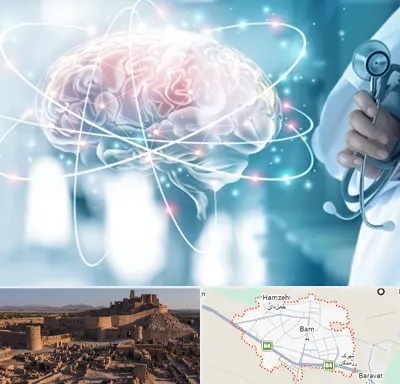 دکتر سکته مغزی در بم