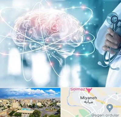 دکتر سکته مغزی در میانه