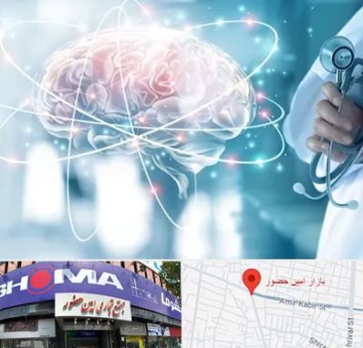 دکتر سکته مغزی در امین حضور