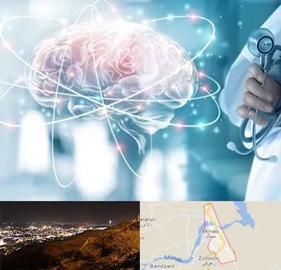 دکتر سکته مغزی در میناب