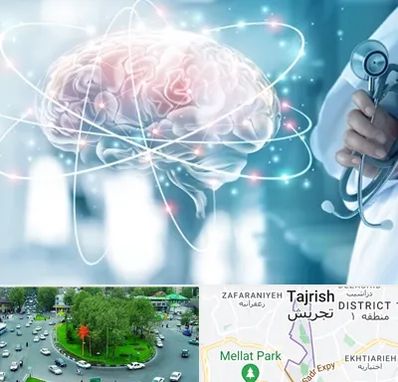 دکتر سکته مغزی در تجریش 