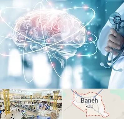 دکتر سکته مغزی در بانه