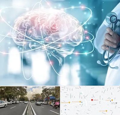 دکتر سکته مغزی در دولت 