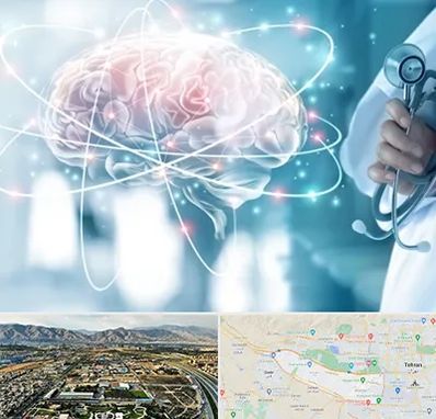 دکتر سکته مغزی در منطقه 21 تهران 